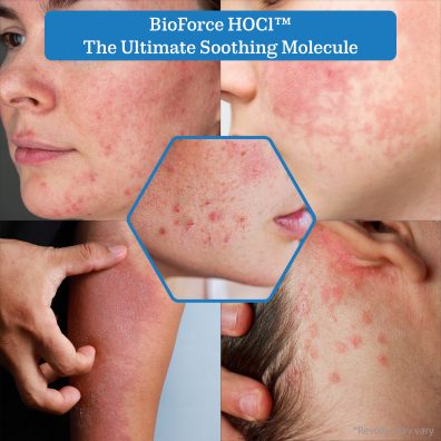 BioForce HOCl - Pure Hypochlorous Acid Spray for Face & Body - 242 ml - Image 9